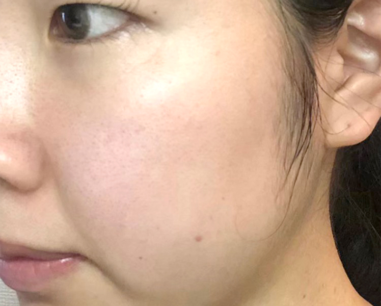 マトリックスエキス　お試し　navis 24日目②